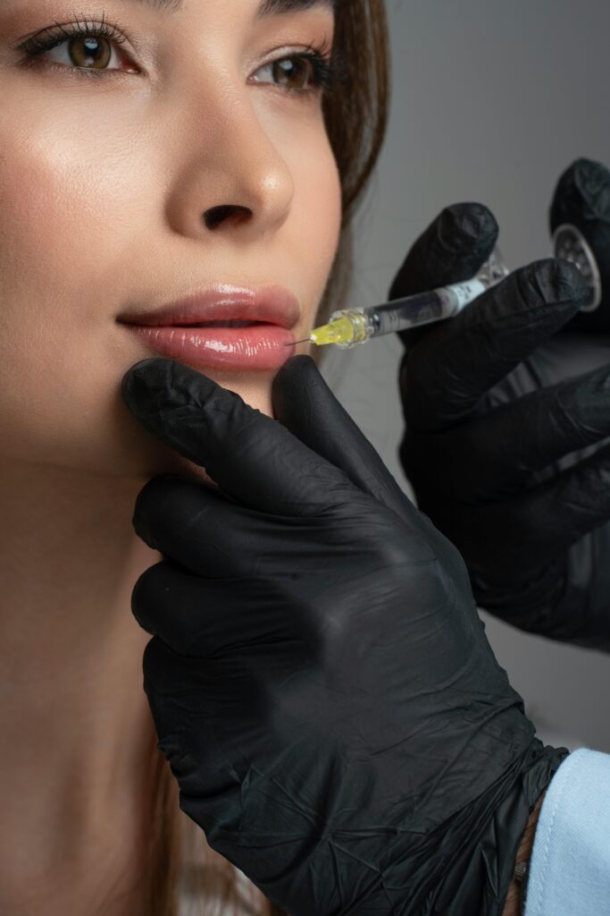 Detailed image of a cosmetic lip injection being administered by a professional.